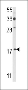 PDRG1 Antibody - Western blot of PDRG Antibody in A2058 cell line lysates (35 ug/lane). PDRG (arrow) was detected using the purified antibody.