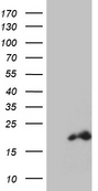 PDRG1 Antibody - HEK293T cells were transfected with the pCMV6-ENTRY control. (Left lane) or pCMV6-ENTRY PDRG1. (Right lane) cDNA for 48 hrs and lysed