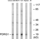 PDRG1 Antibody - Western blot analysis of lysates from Jurkat, COLO, MCF-7, and HepG2 cells, using PDRG1 Antibody. The lane on the right is blocked with the synthesized peptide.