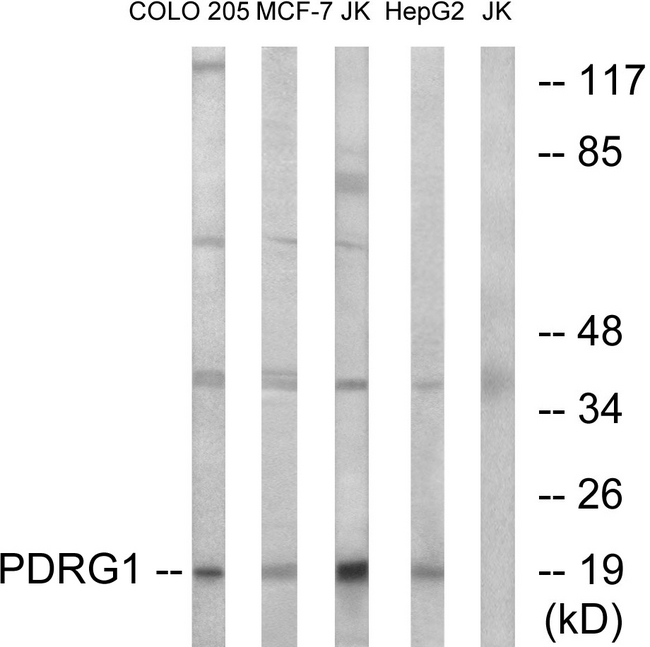 PDRG1 Antibody - Western blot analysis of lysates from Jurkat, COLO, MCF-7, and HepG2 cells, using PDRG1 Antibody. The lane on the right is blocked with the synthesized peptide.