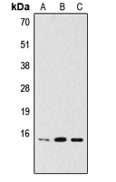 PDRG1 Antibody - Western blot analysis of PDRG1 expression in HeLa (A); MCF7 (B); A2058 (C) whole cell lysates.