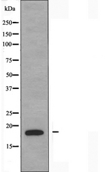 PDRG1 Antibody - Western blot analysis of extracts of COLO cells using PDRG1 antibody.