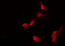 PDRG1 Antibody - Staining HeLa cells by IF/ICC. The samples were fixed with PFA and permeabilized in 0.1% Triton X-100, then blocked in 10% serum for 45 min at 25°C. The primary antibody was diluted at 1:200 and incubated with the sample for 1 hour at 37°C. An Alexa Fluor 594 conjugated goat anti-rabbit IgG (H+L) Ab, diluted at 1/600, was used as the secondary antibody.
