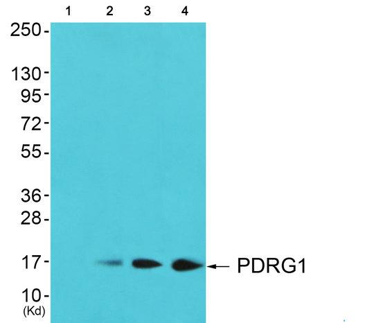 PDRG1 Antibody - Western blot analysis of extracts from JK cells, COS7 cells and 293 cells, using PDRG1 antibody.
