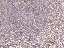 PDRG1 Antibody - Immunohistochemistry of paraffin-embedded Human tonsil tissue  using PDRG1 Polyclonal Antibody at dilution of 1:80(×200)