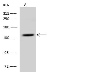 PDS5A Antibody - Anti-PDS5A rabbit polyclonal antibody at 1:500 dilution. Lane A: U-251 MG Whole Cell Lysate. Lysates/proteins at 30 ug per lane. Secondary: Goat Anti-Rabbit IgG (H+L)/HRP at 1/10000 dilution. Developed using the ECL technique. Performed under reducing conditions. Predicted band size: 150 kDa. Observed band size: 150 kDa.