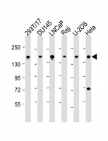 PDS5B / AS3 Antibody - All lanes: Anti-PDS5B Antibody (C-Term) at 1:2000 dilution. Lane 1: 293T/17 whole cell lysate. Lane 2: DU145 whole cell lysate. Lane 3: LNCaP whole cell lysate. Lane 4: Raji whole cell lysate. Lane 5: U-2OS whole cell lysate. Lane 6: HeLa whole cell lysate Lysates/proteins at 20 ug per lane. Secondary Goat Anti-Rabbit IgG, (H+L), Peroxidase conjugated at 1:10000 dilution. Predicted band size: 165 kDa. Blocking/Dilution buffer: 5% NFDM/TBST.