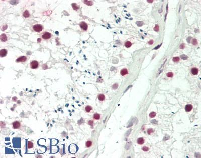 PDS5B / AS3 Antibody - Human Testis: Formalin-Fixed, Paraffin-Embedded (FFPE)