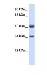 PDSS2 / DLP1 Antibody - Fetal muscle lysate. Antibody concentration: 1.0 ug/ml. Gel concentration: 12%.  This image was taken for the unconjugated form of this product. Other forms have not been tested.