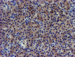 PDSS2 / DLP1 Antibody - IHC of paraffin-embedded Human pancreas tissue using anti-PDSS2 mouse monoclonal antibody.