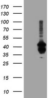 PDSS2 / DLP1 Antibody - HEK293T cells were transfected with the pCMV6-ENTRY control (Left lane) or pCMV6-ENTRY PDSS2 (Right lane) cDNA for 48 hrs and lysed. Equivalent amounts of cell lysates (5 ug per lane) were separated by SDS-PAGE and immunoblotted with anti-PDSS2.
