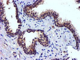 PDSS2 / DLP1 Antibody - IHC of paraffin-embedded Human prostate tissue using anti-PDSS2 mouse monoclonal antibody.