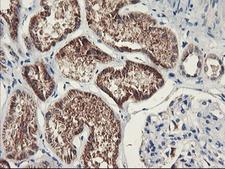 PDSS2 / DLP1 Antibody - IHC of paraffin-embedded Human Kidney tissue using anti-PDSS2 mouse monoclonal antibody.