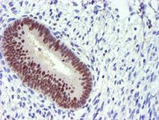 PDSS2 / DLP1 Antibody - IHC of paraffin-embedded Human endometrium tissue using anti-PDSS2 mouse monoclonal antibody.