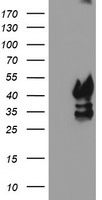 PDSS2 / DLP1 Antibody - HEK293T cells were transfected with the pCMV6-ENTRY control (Left lane) or pCMV6-ENTRY PDSS2 (Right lane) cDNA for 48 hrs and lysed. Equivalent amounts of cell lysates (5 ug per lane) were separated by SDS-PAGE and immunoblotted with anti-PDSS2.