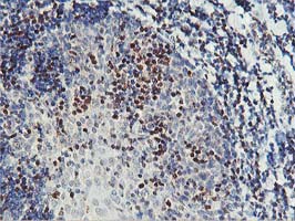 PDSS2 / DLP1 Antibody - IHC of paraffin-embedded Human lymph node tissue using anti-PDSS2 mouse monoclonal antibody.