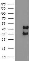 PDSS2 / DLP1 Antibody - HEK293T cells were transfected with the pCMV6-ENTRY control (Left lane) or pCMV6-ENTRY PDSS2 (Right lane) cDNA for 48 hrs and lysed. Equivalent amounts of cell lysates (5 ug per lane) were separated by SDS-PAGE and immunoblotted with anti-PDSS2.