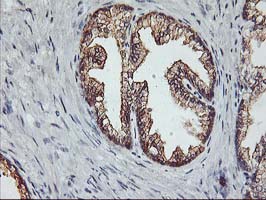 PDSS2 / DLP1 Antibody - IHC of paraffin-embedded Human prostate tissue using anti-PDSS2 mouse monoclonal antibody. (Heat-induced epitope retrieval by 10mM citric buffer, pH6.0, 100C for 10min).