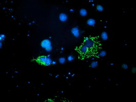 PDSS2 / DLP1 Antibody - Anti-PDSS2 mouse monoclonal antibody immunofluorescent staining of COS7 cells transiently transfected by pCMV6-ENTRY PDSS2.