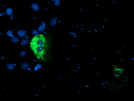 PDSS2 / DLP1 Antibody - Anti-PDSS2 mouse monoclonal antibody immunofluorescent staining of COS7 cells transiently transfected by pCMV6-ENTRY PDSS2.