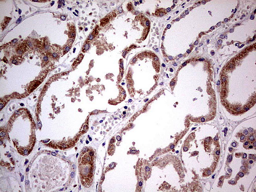 PDSS2 / DLP1 Antibody - Immunohistochemical staining of paraffin-embedded Human Kidney tissue using anti-PDSS2 mouse monoclonal antibody.  heat-induced epitope retrieval by 1 mM EDTA in 10mM Tris, pH8.0, 120C for 3min)
