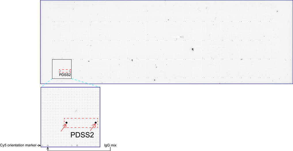 PDSS2 / DLP1 Antibody - OriGene overexpression protein microarray chip was immunostained with UltraMAB anti-PDSS2 mouse monoclonal antibody. The positive reactive proteins are highlighted with two red arrows in the enlarged subarray. All the positive controls spotted in this subarray are also labeled for clarification.