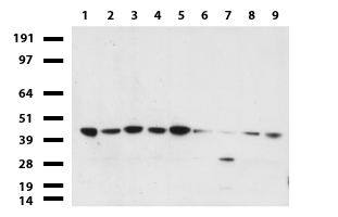 PDSS2 / DLP1 Antibody - Western blot of cell lysates. (35ug) from 9 different cell lines. (1: HepG2, 2: HeLa, 3: SV-T2, 4: A549. 5: COS7, 6: Jurkat, 7: MDCK, 8: PC-12, 9: MCF7).