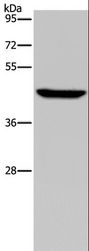 PDSS2 / DLP1 Antibody - Western blot analysis of HeLa cell, using PDSS2 Polyclonal Antibody at dilution of 1:400.