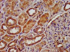 PDSS2 / DLP1 Antibody - Immunohistochemistry image at a dilution of 1:200 and staining in paraffin-embedded human kidney tissue performed on a Leica BondTM system. After dewaxing and hydration, antigen retrieval was mediated by high pressure in a citrate buffer (pH 6.0) . Section was blocked with 10% normal goat serum 30min at RT. Then primary antibody (1% BSA) was incubated at 4 °C overnight. The primary is detected by a biotinylated secondary antibody and visualized using an HRP conjugated SP system.