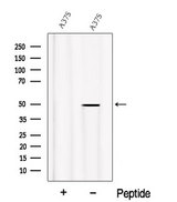 PDSS2 / DLP1 Antibody - Western blot analysis of extracts of A375 cells using PDSS2 antibody. The lane on the left was treated with blocking peptide.