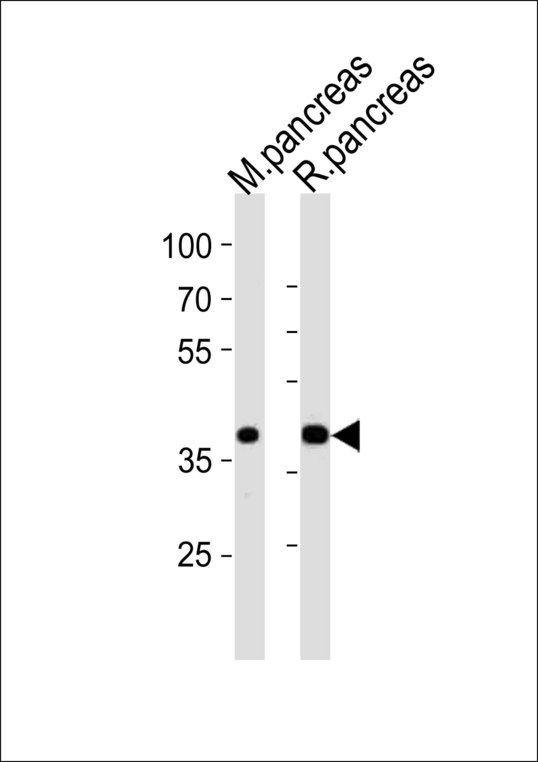 PDX1 Antibody - Western blot of lysates from mouse pancreas and rat pancreas tissue (from left to right) with PDX1 Antibody. Antibody was diluted at 1:1000 at each lane. A goat anti-rabbit IgG H&L (HRP) at 1:10000 dilution was used as the secondary antibody. Lysates at 20 ug per lane.