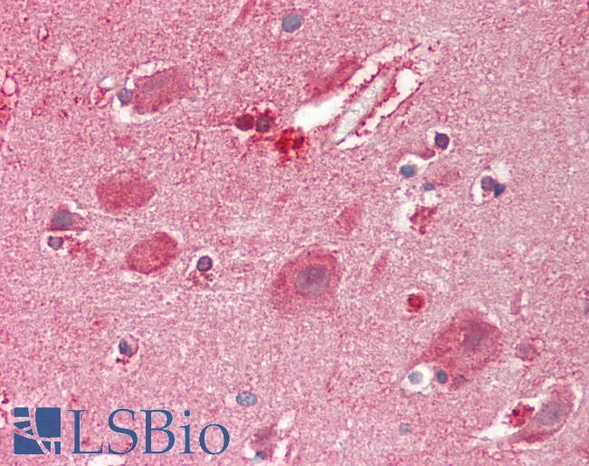 PDX1 Antibody - Human Brain, Cortex: Formalin-Fixed, Paraffin-Embedded (FFPE).  This image was taken for the unconjugated form of this product. Other forms have not been tested.