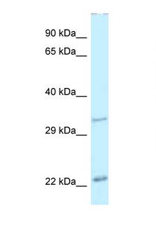 PDX1 Antibody - PDX1 antibody Western blot of Mouse Pancreas lysate. Antibody concentration 1 ug/ml. This image was taken for the unconjugated form of this product. Other forms have not been tested.