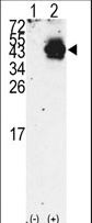 PDX1 Antibody - Western blot of PDX1 (arrow) using rabbit polyclonal PDX1 Antibody (RB10459). 293 cell lysates (2 ug/lane) either nontransfected (Lane 1) or transiently transfected with the PDX1 gene (Lane 2) (Origene Technologies).