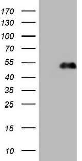 PDX1 Antibody - HEK293T cells were transfected with the pCMV6-ENTRY control (Left lane) or pCMV6-ENTRY PDX1 (Right lane) cDNA for 48 hrs and lysed. Equivalent amounts of cell lysates (5 ug per lane) were separated by SDS-PAGE and immunoblotted with anti-PDX1.