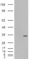 PDX1 Antibody - HEK293T cells were transfected with the pCMV6-ENTRY control (Left lane) or pCMV6-ENTRY PDX1 (Right lane) cDNA for 48 hrs and lysed. Equivalent amounts of cell lysates (5 ug per lane) were separated by SDS-PAGE and immunoblotted with anti-PDX1.