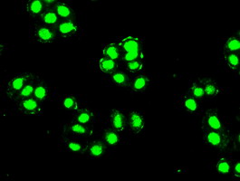 PDX1 Antibody - Anti-PDX1 mouse monoclonal antibody  immunofluorescent staining of HeLa cells transiently transfected by pCMV6-ENTRY PDX1.