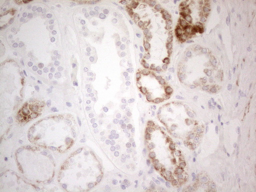 PDX1 Antibody - Immunohistochemical staining of paraffin-embedded Human Kidney tissue using anti-PDX1 mouse monoclonal antibody. (Heat-induced epitope retrieval by 1mM EDTA in 10mM Tris buffer. (pH8.5) at 120°C for 3 min. (1:150)
