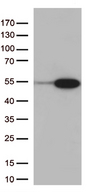 PDX1 Antibody - HEK293T cells were transfected with the pCMV6-ENTRY control. (Left lane) or pCMV6-ENTRY PDX1. (Right lane) cDNA for 48 hrs and lysed. Equivalent amounts of cell lysates. (5 ug per lane) were separated by SDS-PAGE and immunoblotted with anti-PDX1. (1:2000)