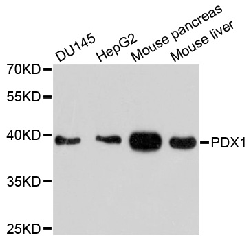 PDX1 Antibody - Western blot analysis of extracts of various cell lines, using PDX1 antibody at 1:1000 dilution. The secondary antibody used was an HRP Goat Anti-Rabbit IgG (H+L) at 1:10000 dilution. Lysates were loaded 25ug per lane and 3% nonfat dry milk in TBST was used for blocking. An ECL Kit was used for detection and the exposure time was 90s.