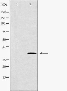PDX1 Antibody - Western blot analysis of Jurkat whole cells lysates using PDX1 antibody. The lane on the left is treated with the antigen-specific peptide.