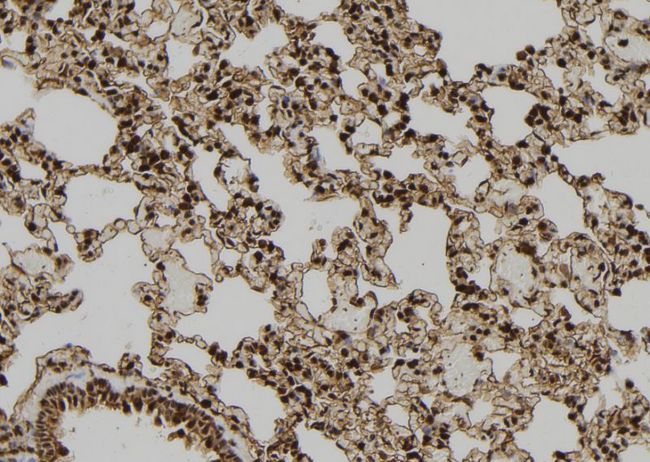 PDX1 Antibody - 1:100 staining rat lung tissue by IHC-P. The sample was formaldehyde fixed and a heat mediated antigen retrieval step in citrate buffer was performed. The sample was then blocked and incubated with the antibody for 1.5 hours at 22°C. An HRP conjugated goat anti-rabbit antibody was used as the secondary.