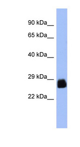 PDX1 Antibody - PDX1 antibody Western blot of PANC1 cell lysate. This image was taken for the unconjugated form of this product. Other forms have not been tested.