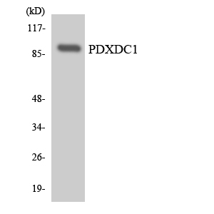 PDXDC1 Antibody - Western blot analysis of the lysates from HeLa cells using PDXDC1 antibody.