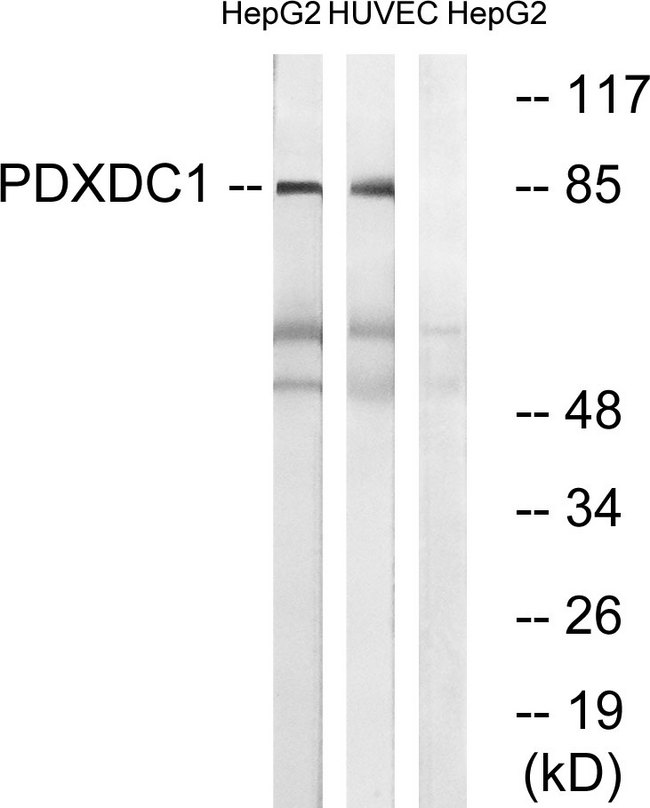 PDXDC1 Antibody - Western blot analysis of lysates from HepG2 and HUVEC cells, using PDXDC1 Antibody. The lane on the right is blocked with the synthesized peptide.