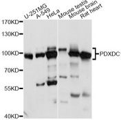PDXDC1 Antibody - Western blot analysis of extracts of various cell lines, using PDXDC1 antibody at 1:1000 dilution. The secondary antibody used was an HRP Goat Anti-Rabbit IgG (H+L) at 1:10000 dilution. Lysates were loaded 25ug per lane and 3% nonfat dry milk in TBST was used for blocking. An ECL Kit was used for detection and the exposure time was 30s.