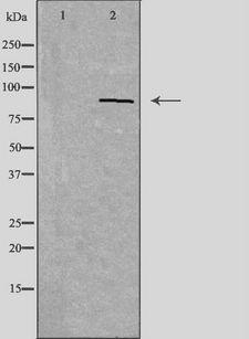 PDXDC1 Antibody - Western blot analysis of extracts of HepG2 cells using PDXDC1 antibody. The lane on the left is treated with the antigen-specific peptide.