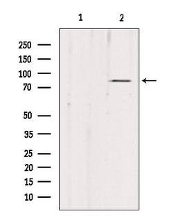 PDXDC1 Antibody - Western blot analysis of extracts of mouse brain tissue using PDXDC1 antibody. Lane 1 was treated with the blocking peptide.