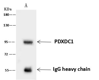 PDXDC1 Antibody - PDXDC1 was immunoprecipitated using: Lane A: 0.5 mg U-251MG Whole Cell Lysate. 4 uL anti-PDXDC1 rabbit polyclonal antibody and 60 ug of Immunomagnetic beads Protein A/G. Primary antibody: Anti-PDXDC1 rabbit polyclonal antibody, at 1:100 dilution. Secondary antibody: Goat Anti-Rabbit IgG (H+L)/HRP at 1/10000 dilution. Developed using the ECL technique. Performed under reducing conditions. Predicted band size: 87 kDa. Observed band size: 95 kDa.