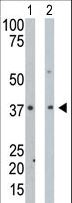 PDXK / PNK Antibody - The anti-PDXK antibody is used in Western blot to detect PDXK in mouse intestine tissue lysate (Lane 1) and HeLa cell lysate (Lane 2).